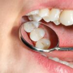 Top Questions to Ask Your Family Dentist During Your Visit 