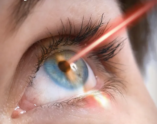 What are the Main Benefits of LASIK?